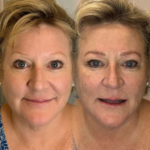 CC16F472-C512-423C-8D2E-23CCFB1EB939